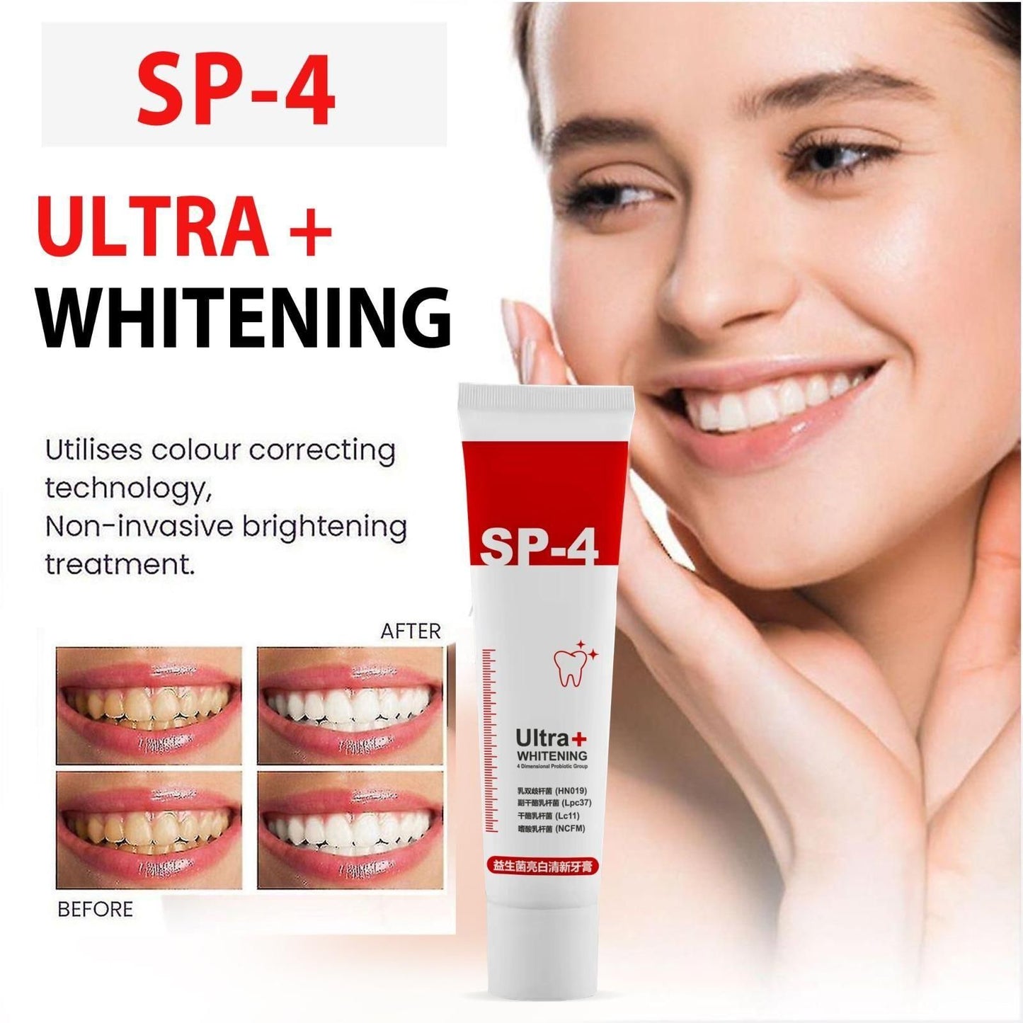 SP-4 Ultra+ Whitening Teeth1